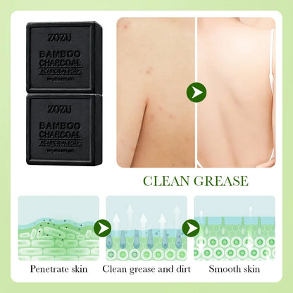 Bamboo Charcoal Cleansing Soap (with Foaming Net), Oil-Removing Bamboo Charcoal Handmade Soap for Bathing, Rich Foam, Easy to Clean, Deeply Removes Skin Oil, Dirt, and Mites, Leaves Skin Clean, Fresh, and Comfortable after Cl